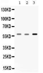 Anti-Catalase Antibody