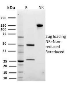 SDS-PAGE analysis of Anti-ARF1 Antibody [3F1] under non-reduced and reduced conditions; showing intact IgG and intact heavy and light chains, respectively. SDS-PAGE analysis confirms the integrity and purity of the antibody