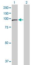 Anti-NCSTN Rabbit Polyclonal Antibody