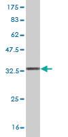 Anti-CEP250 Mouse Monoclonal Antibody [clone: 4A1]