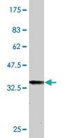 Anti-TSHZ1 Mouse Monoclonal Antibody [clone: 2F1]