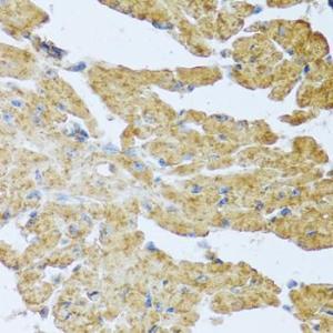 Immunohistochemistry analysis of paraffin-embedded mouse heart using Anti-IL-20 Antibody (A11996) at a dilution of 1:100 (40x lens) Perform microwave antigen retrieval with 10 mM PBS buffer pH 72 before commencing with IHC staining protocol