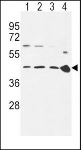 Anti-CCR7 Rabbit Polyclonal Antibody (FITC (Fluorescein Isothiocyanate))