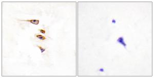 Immunohistochemical analysis of paraffin-embedded human brain tissue using Anti-EPHA6 Antibody. The right hand panel represents a negative control, where the antibody was pre-incubated with the immunising peptide.