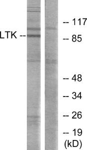 Western blot analysis of lysates from Jurkat cells using Anti-LTK Antibody. The right hand lane represents a negative control, where the antibody is blocked by the immunising peptide