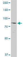 Anti-NCSTN Rabbit Polyclonal Antibody