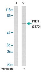 Anti-PTEN Rabbit Polyclonal Antibody