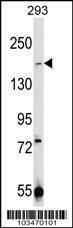 Anti-TRPM7 Rabbit Polyclonal Antibody (AP (Alkaline Phosphatase))