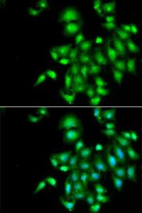 Immunofluorescence analysis of A549 cells using Anti-IL-20 Antibody (A11996) DAPI was used to stain the cell nuclei (blue)