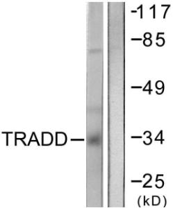 Western blot analysis of lysates from COS7 cells using Anti-TRADD Antibody. The right hand lane represents a negative control, where the Antibody is blocked by the immunising peptide