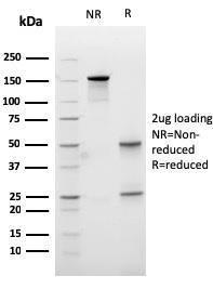 SDS-PAGE analysis of Anti-Carboxypeptidase A1 Antibody [CPA1/2713] under non-reduced and reduced conditions; showing intact IgG and intact heavy and light chains, respectively. SDS-PAGE analysis confirms the integrity and purity of the Antibody