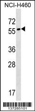 Anti-SYT17 Rabbit Polyclonal Antibody