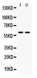 Anti-CCT3 Antibody