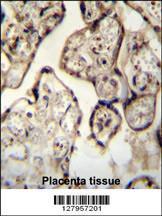 Anti-SYT8 Rabbit Polyclonal Antibody (FITC (Fluorescein Isothiocyanate))