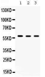 Anti-TCP1 delta Antibody