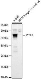 Western blot analysis of various lysates, using Anti-L-Kynurenine Hydrolase Antibody (A11998) at 1:400 dilution. The secondary Antibody was Goat Anti-Rabbit IgG H&L Antibody (HRP) at 1:10000 dilution. Lysates/proteins were present at 25 µg per lane