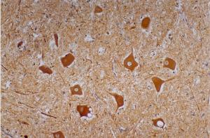 Immunohistochemistry staining of human cerebellum (paraffin-embedded sections) with Anti-Neurofilament heavy protein Antibody (A85597 / 5 µg/ml)