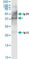 Anti-ECI2 Rabbit Polyclonal Antibody