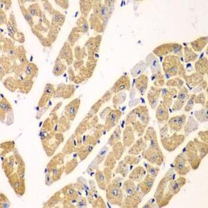 Immunohistochemistry analysis of paraffin-embedded mouse heart using Anti-L-Kynurenine Hydrolase Antibody (A11998) at a dilution of 1:100 (40X lens). Perform microwave antigen retrieval with 10 mM PBS buffer pH 7.2 before commencing with IHC staining protocol