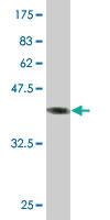 Anti-HIST2H2AA3 Mouse Monoclonal Antibody [clone: 4C10]