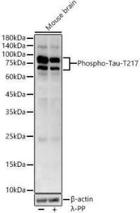 Western blot analysis of various lysates, using Anti-Tau (phospho Thr217) Antibody (A306679) at 1:600 dilution