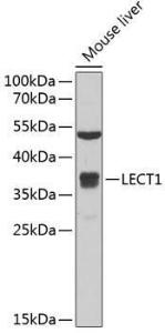 Anti-LECT1 antibody