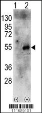 Anti-RPS6KB2 Rabbit Polyclonal Antibody