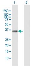 Anti-FN3K Rabbit Polyclonal Antibody