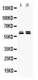 Anti-TCP1 epsilon Antibody