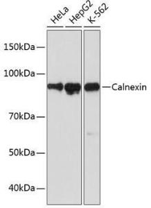 Western blot analysis of extracts of various cell lines, using Anti-Calnexin Antibody [ARC0648] (A306680) at 1:1000 dilution. The secondary Antibody was Goat Anti-Rabbit IgG H&L Antibody (HRP) at 1:10000 dilution. Lysates/proteins were present at 25 µg per lane