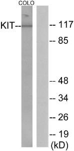 Western blot analysis of lysates from COLO205 cells using Anti-KIT Antibody. The right hand lane represents a negative control, where the antibody is blocked by the immunising peptide.