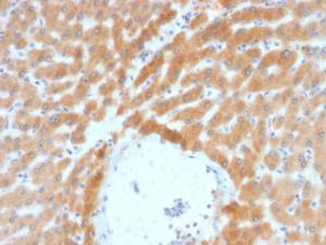 Immunohistochemical analysis of formalin-fixed, paraffin-embedded human liver using Anti-ARF1 Antibody [ARF1/2117]