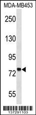 Anti-ZNF16 Rabbit Polyclonal Antibody