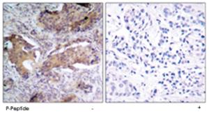 Anti-PTEN Rabbit Polyclonal Antibody