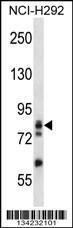 Anti-ADD3 Rabbit Polyclonal Antibody (FITC (Fluorescein Isothiocyanate))