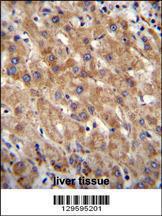 Anti-CHCHD4 Rabbit Polyclonal Antibody (AP (Alkaline Phosphatase))