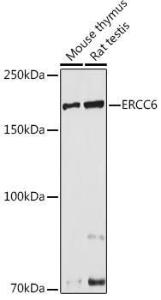 Anti-CSB Rabbit Polyclonal Antibody