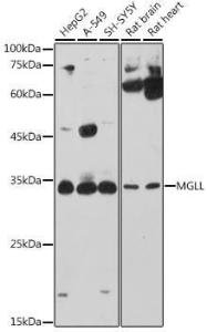 Western blot analysis of extracts of various cell lines, using Anti-Monoacylglycerol Lipase/MGL Antibody (A12000) at 1:1000 dilution. The secondary Antibody was Goat Anti-Rabbit IgG H&L Antibody (HRP) at 1:10000 dilution. Lysates/proteins were present at 25 µg per lane