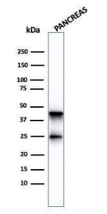 Western blot analysis of pancreatic tissue lysate using Anti-Carboxypeptidase A1 Antibody [CPA1/2713]