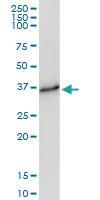 Anti-FN3K Rabbit Polyclonal Antibody