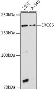 Anti-CSB Rabbit Polyclonal Antibody