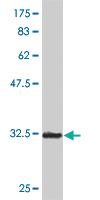 Anti-SOX12 Mouse Monoclonal Antibody [clone: 2C4]