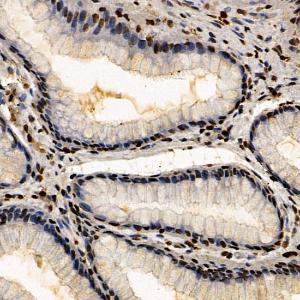 Anti-CSB Rabbit Polyclonal Antibody