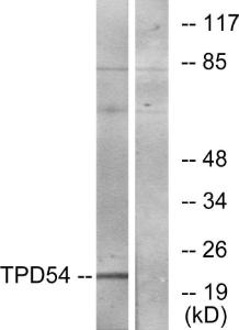 Anti-TPD54 antibody