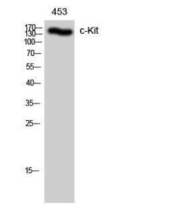 Western blot analysis of 453 cells using Anti-KIT Antibody