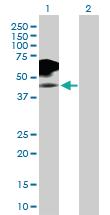 Anti-IL2RG Rabbit Polyclonal Antibody