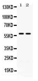 Anti-CD2 Antibody