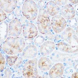 Immunohistochemistry analysis of paraffin-embedded mouse kidney using Anti-Monoacylglycerol Lipase/MGL Antibody (A12000) at a dilution of 1:50 (40X lens). Perform high pressure antigen retrieval with 10 mM citrate buffer pH 6.0 before commencing with IHC staining protocol