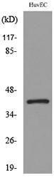 Antibody anti-CXCR2 A101127-100 100 µg