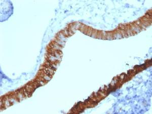 Immunohistochemical analysis of formalin-fixed, paraffin-embedded human ovary using Anti-Cytokeratin 3 Antibody [KRT3/2130]